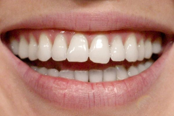 Apr&egrave;s - Isabel