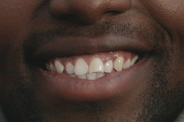 Apr&egrave;s - Kwesi