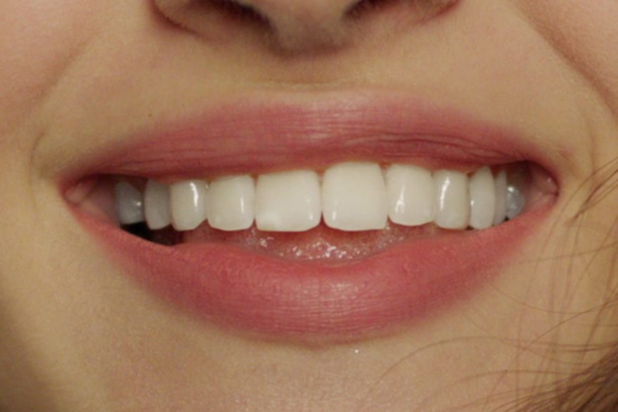 Apr&egrave;s - Sophie