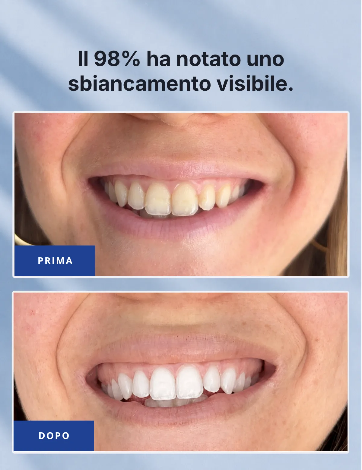 Il 98% ha notato uno sbiancamento visibile – confronto prima/dopo