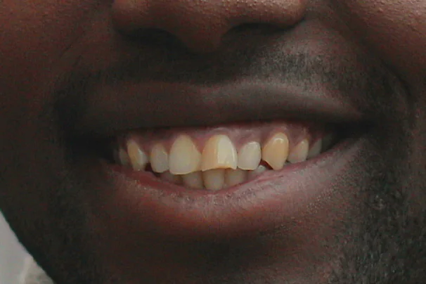 Before - Kwesi