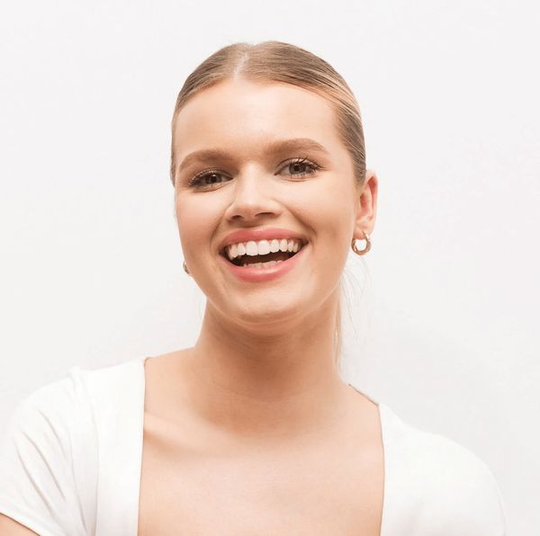 Smilebite Aufhellungs-Visual – Einstieg zum Warum-Abschnitt