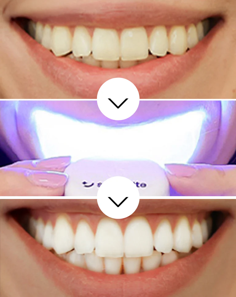 Product photo - Before/After result